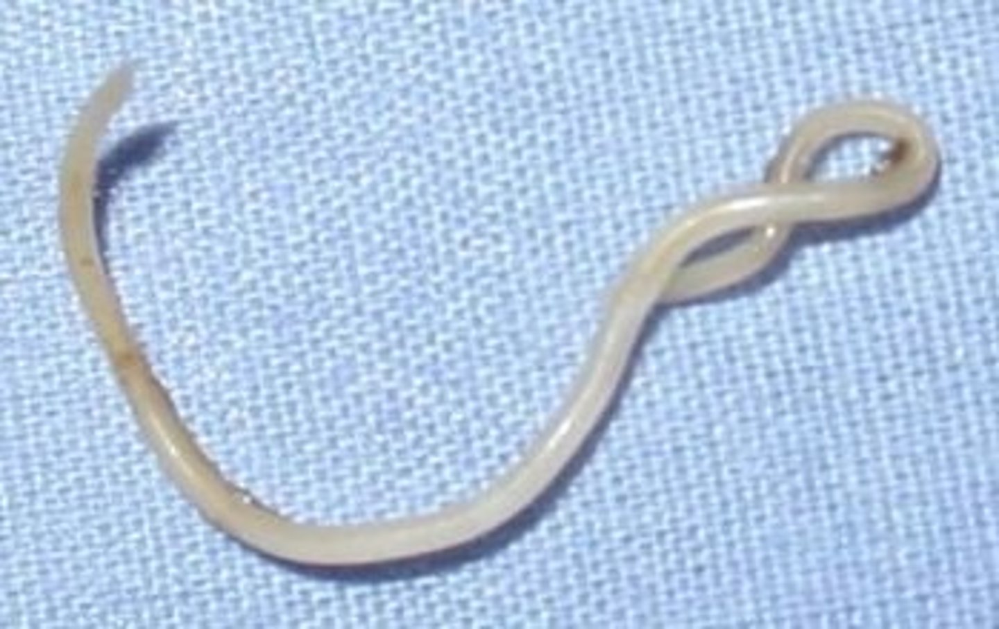 <p>what phylum does this organism belong to?</p>