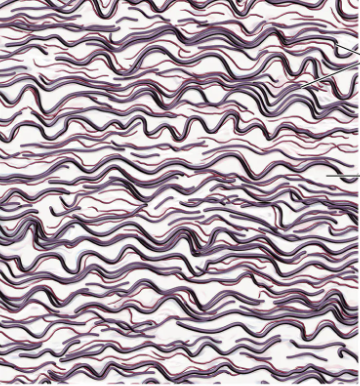 <p>what type of connective tissue is this?</p>