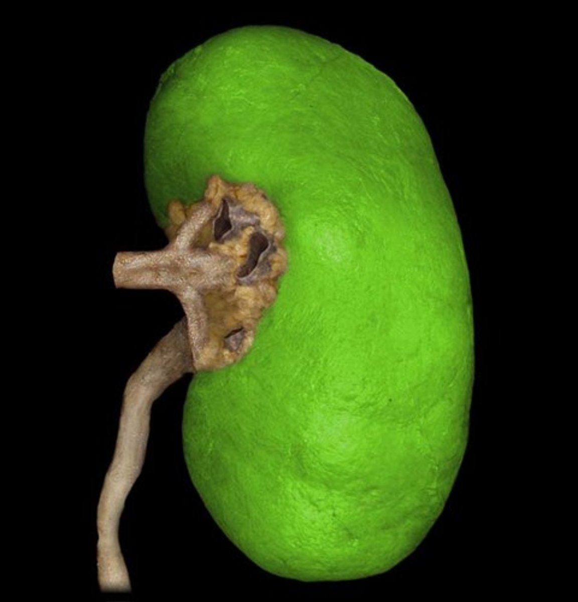 <p>Name the Kidney Region</p>