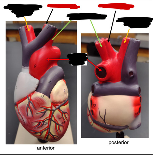 <p>Name this heart vessel</p>