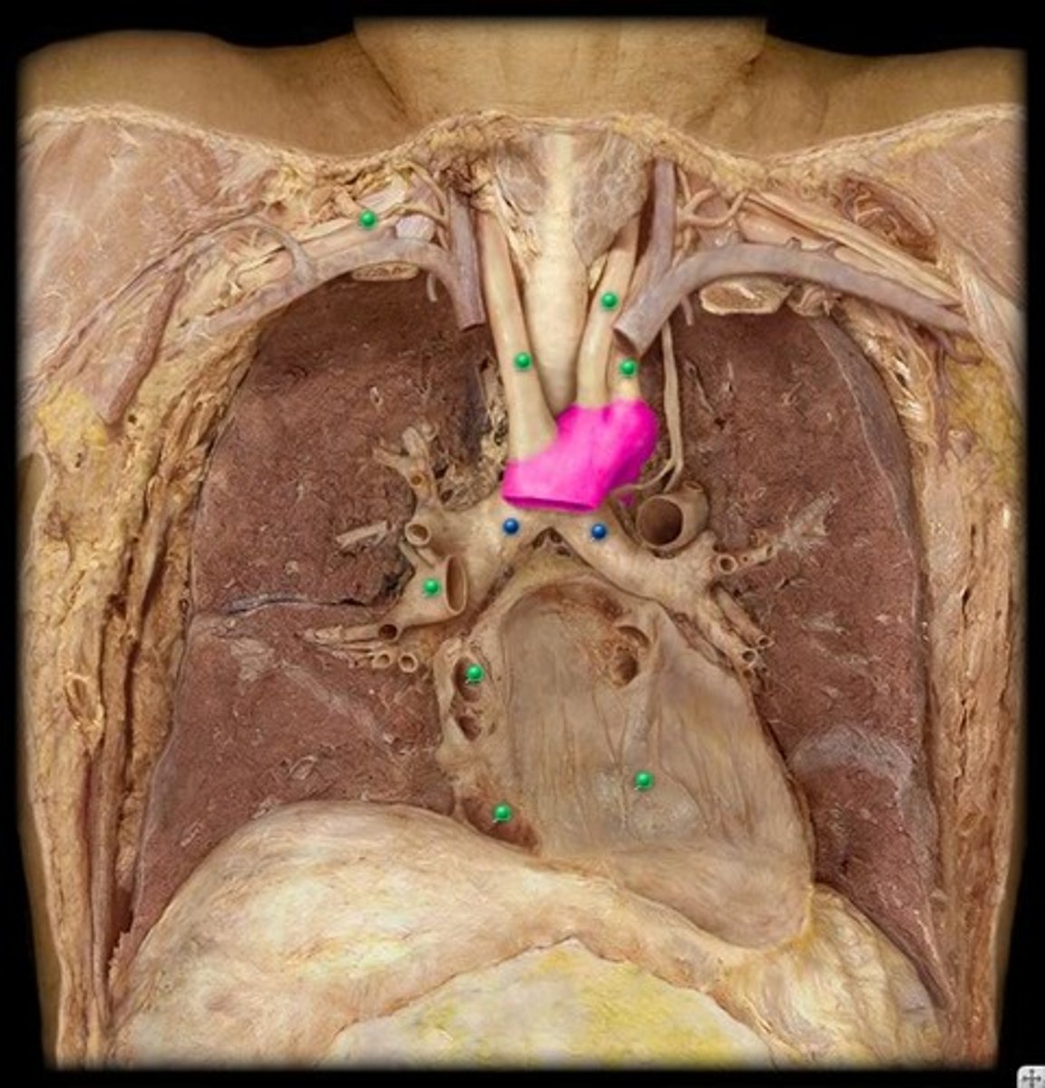 <p>The curved portion of the aorta that connects the ascending aorta to the descending aorta.</p>