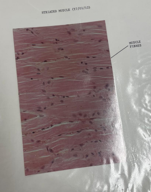 <p>skeletal muscle tissue</p>