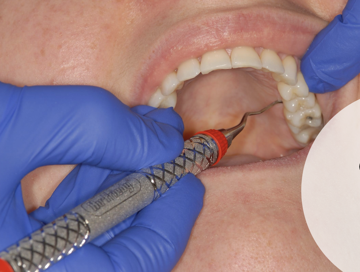 <p>what fulcrum is this </p>