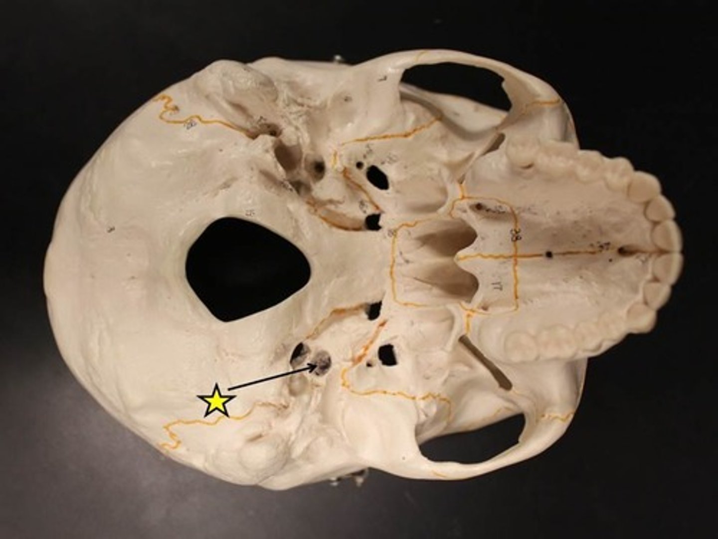 <p>passageway for internal carotid artery</p>