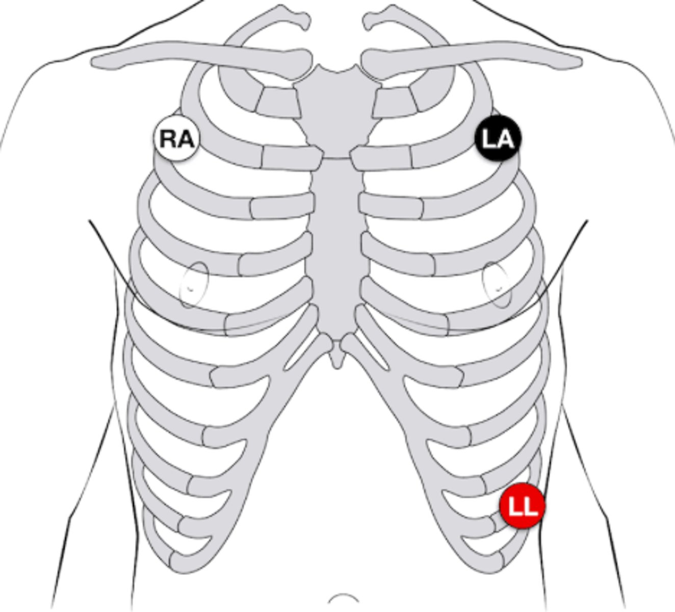 <p>White on right, smoke over fire</p>