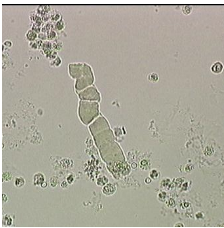 term image
