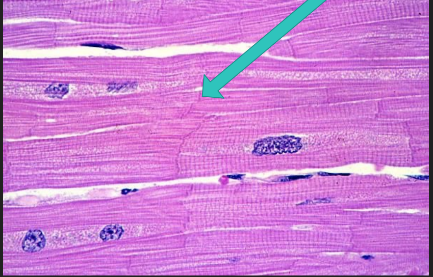 <p>conductive and contractile</p><p>Intercalated discs = gap junctions</p>