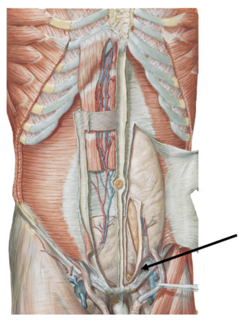 <p><span>The tagged site is most prone to which of the following conditions?</span></p>