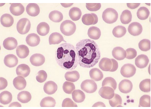 <p>what blood cells are these?</p>