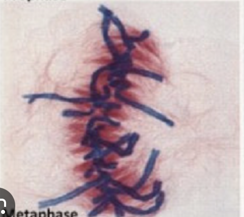 <p>Metaphase</p>