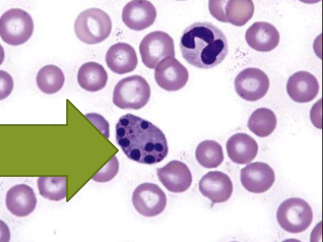 <ul><li><p>fragmentation of nucleus after cell death </p></li></ul><p></p>