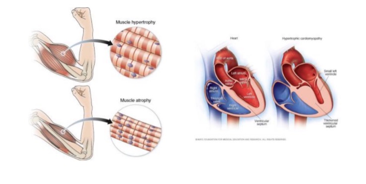 <p>skeletal muscle - increased mass associated with exercise</p><p>cardiac muscle - enlargement of L ventricle in hypertensive heart disease</p><p>nerve tissue</p>