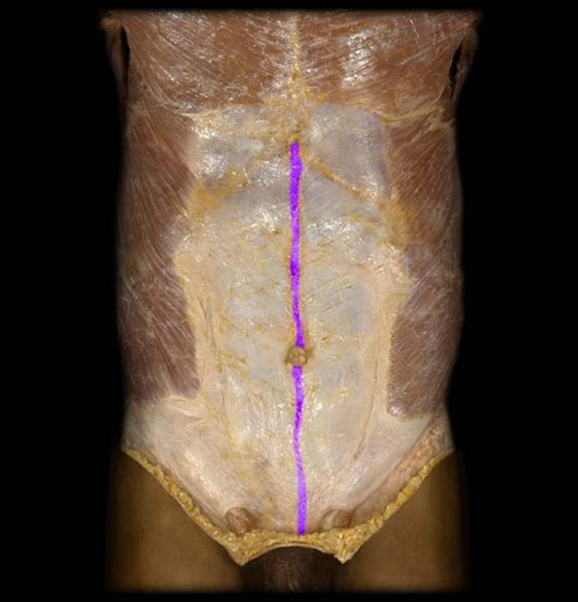<p>midline tendinous seam joining the abdominal muscles</p>