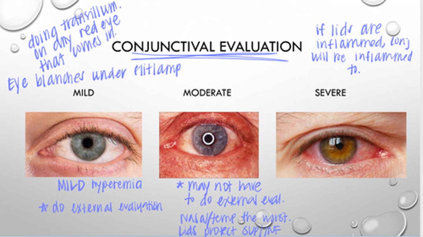 <p>If the lids are inflammed, will the conj be inflammed too most likely?</p>