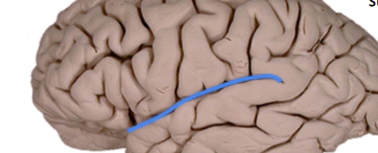 <p>Divides the temporal from frontal and parietal lobes.</p><p>- can't see it from the midsaggital section</p>