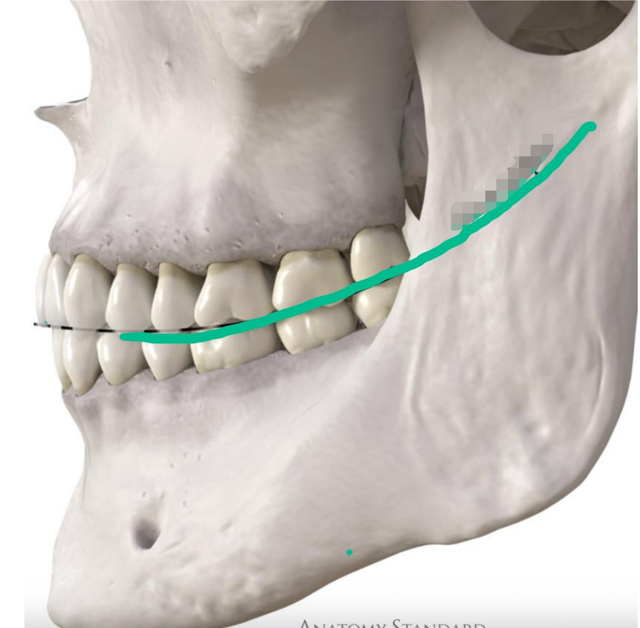 <p>Anterior to posterior position (2 dimensional)</p><ol><li><p>Begins at canines and follows posteriorly</p></li><li><p>Mandibular are concave</p></li><li><p>Maxillary are convex</p></li></ol><p></p>