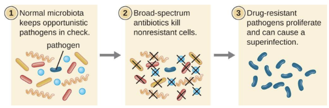 <p>A secondary infection caused when broad-spectrum antibiotics eliminate normal protective microbiota, allowing resistant or opportunistic microbes to overgrow (e.g., C. difficile colitis, Candida yeast infection)</p>