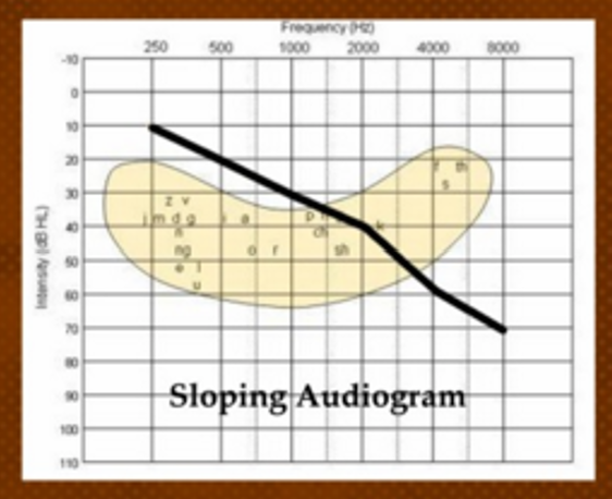 <p>hearing loss begins better than it ends</p>