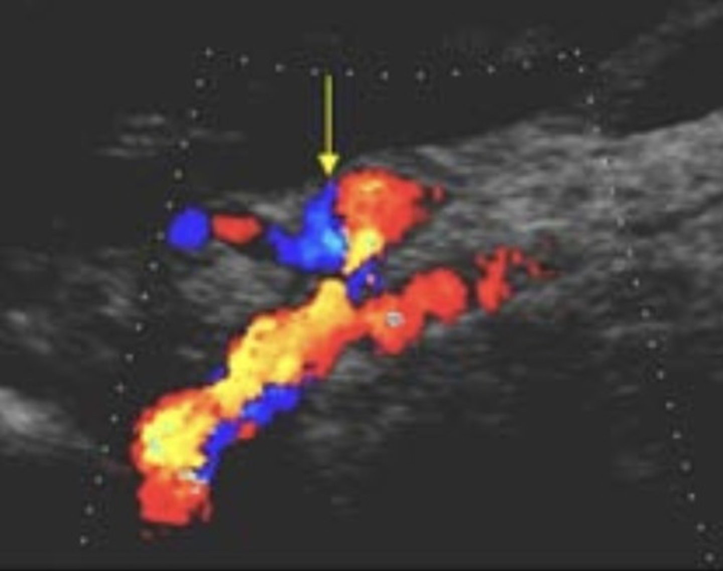 <p>Celiac and SMA come off common trunk</p>