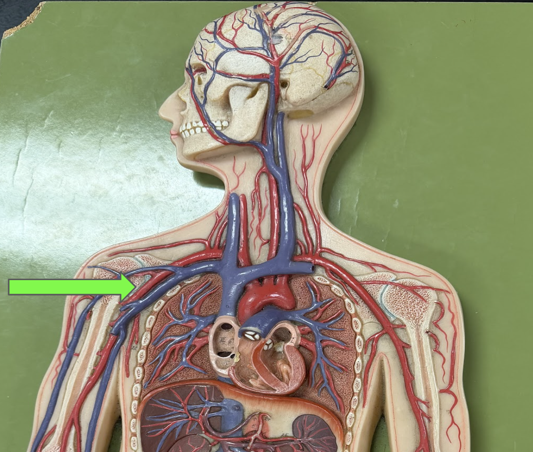 <p>What artery is this</p>