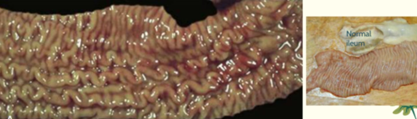 <p>What kind of granuloma is this? What is the dz?</p>