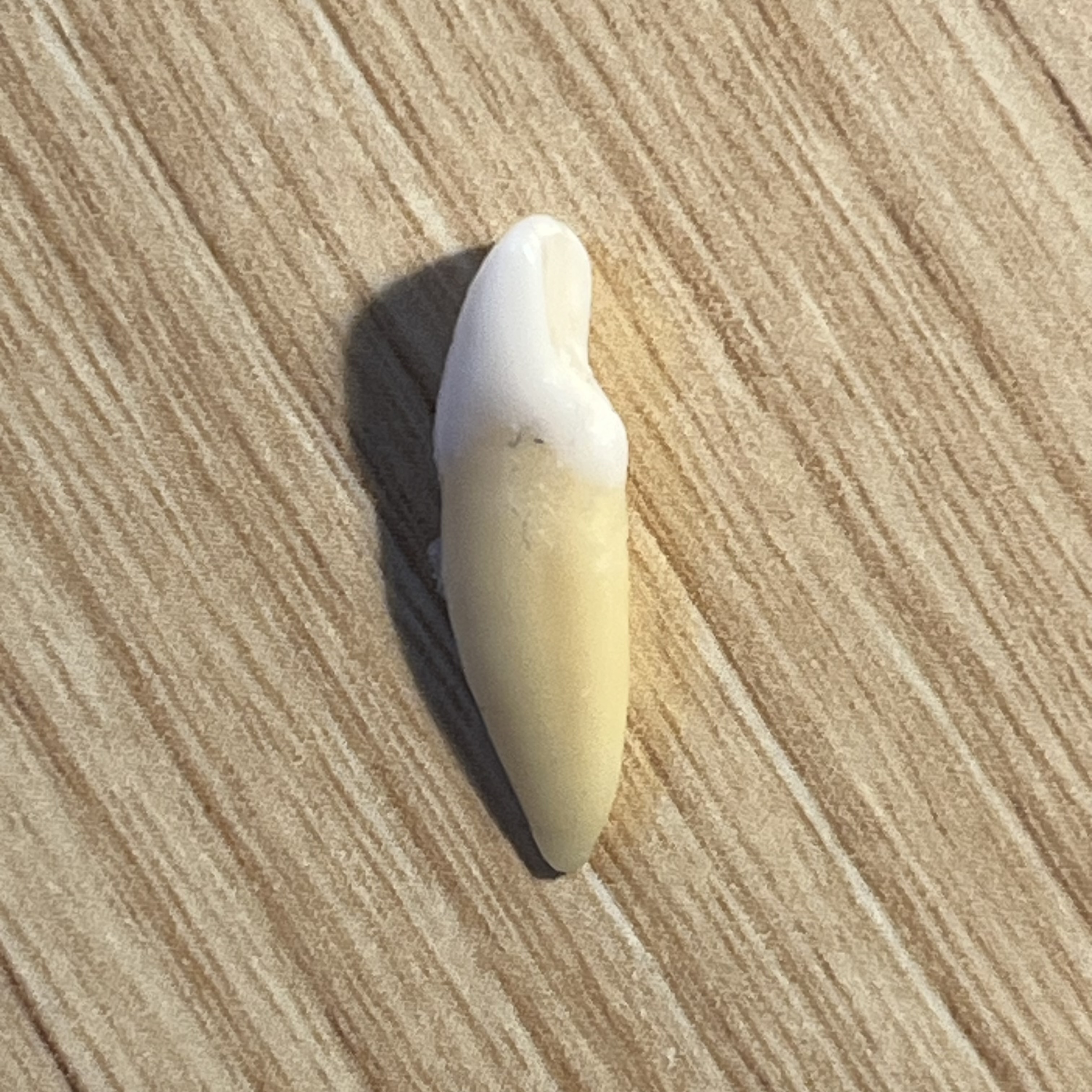 <p>What tooth is this (with view)?</p>