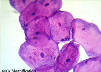 <p>Which of the following processes cannot be occurring in these human epithelial cells, viewed with a light microscope?</p><p>a. DNA synthesis in chromosomes</p><p>b. protein synthesis in the rough ER</p><p>c. separation of sister chromatids</p><p>d. transcription of mRNAs</p><p></p>