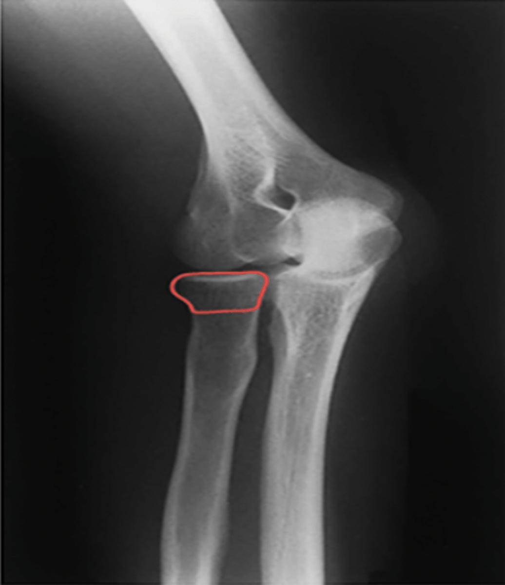 <p>What structure is highlighted?</p>