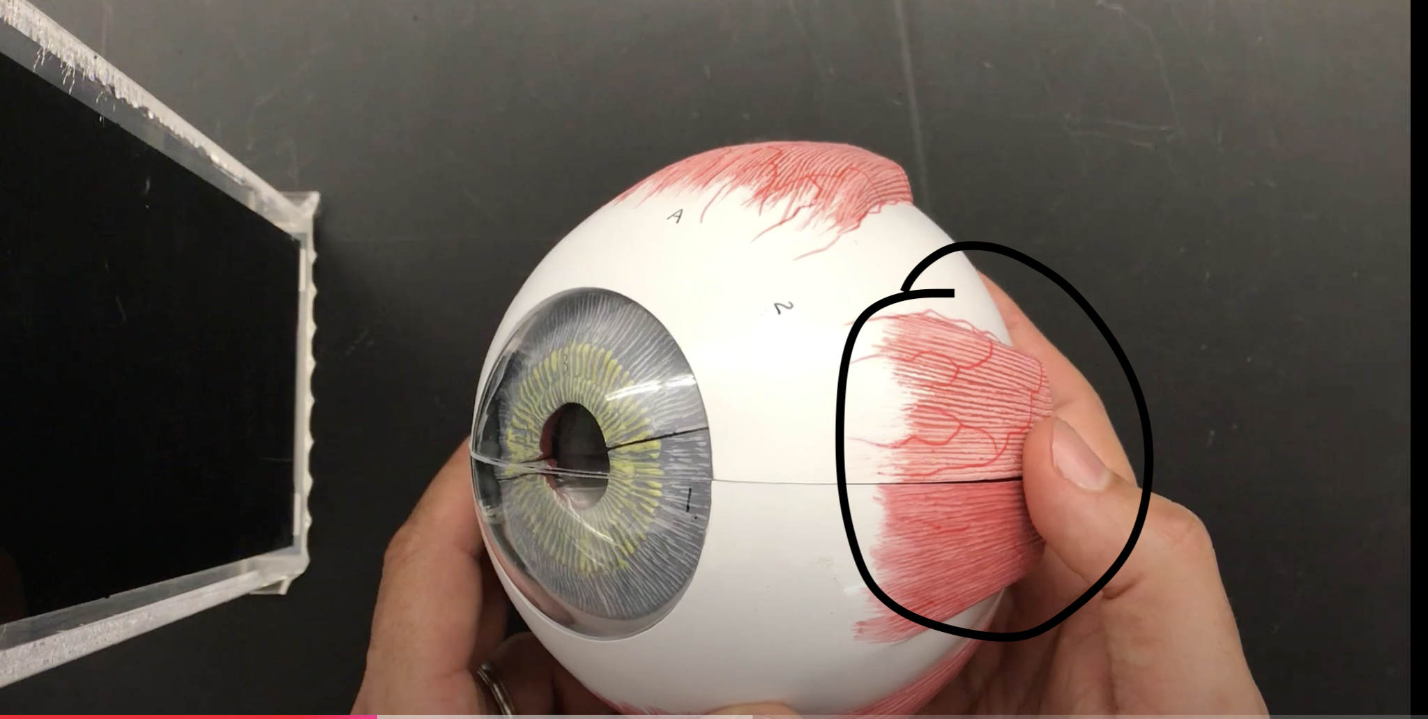 <p>What muscle is this?*****</p>