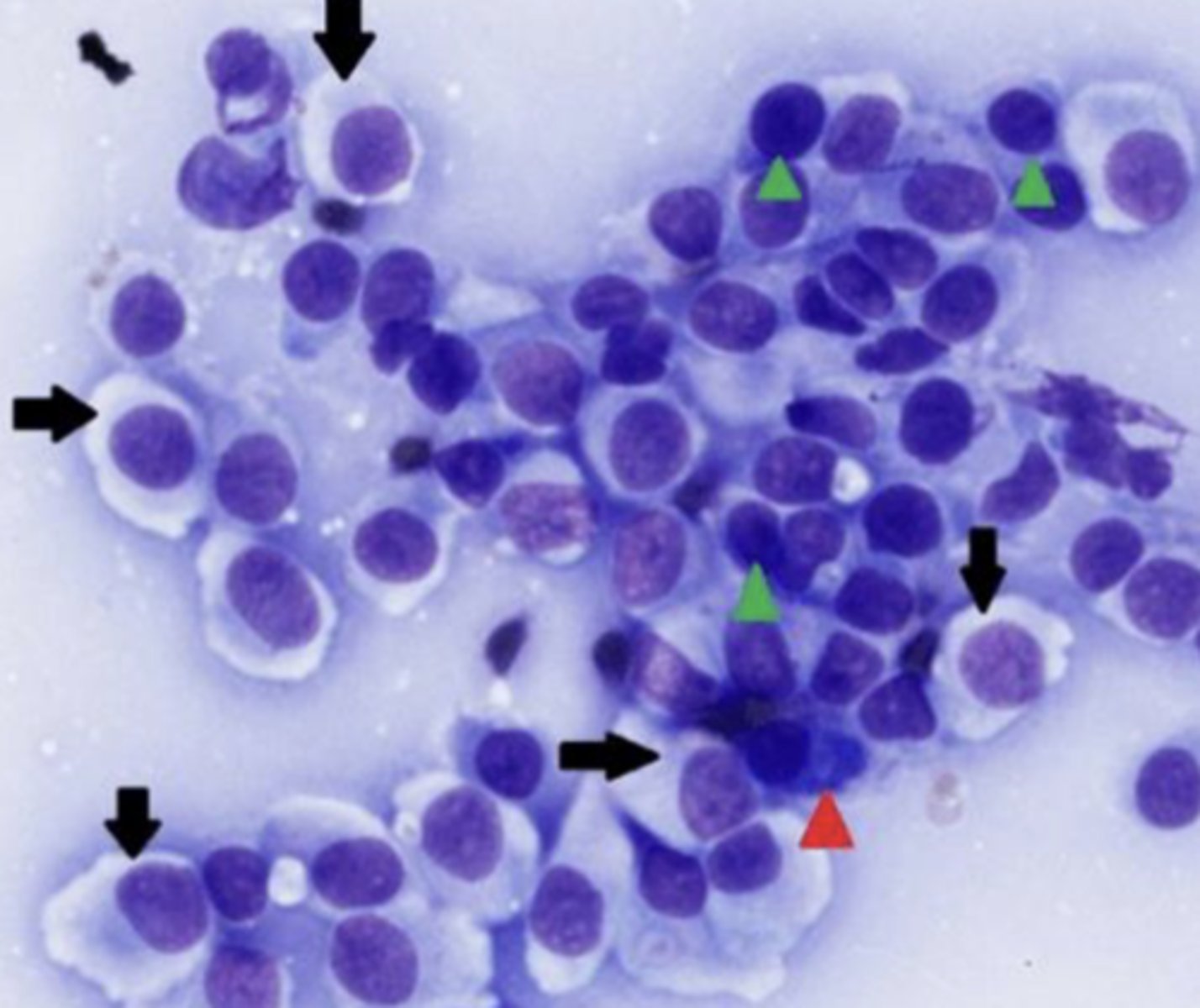 <p>What type of round cell tumor is this?</p>