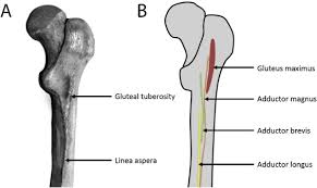<p>Rough vertical ridge on the posterior surface of the femoral shaft; has a lateral and a medial lip.</p>