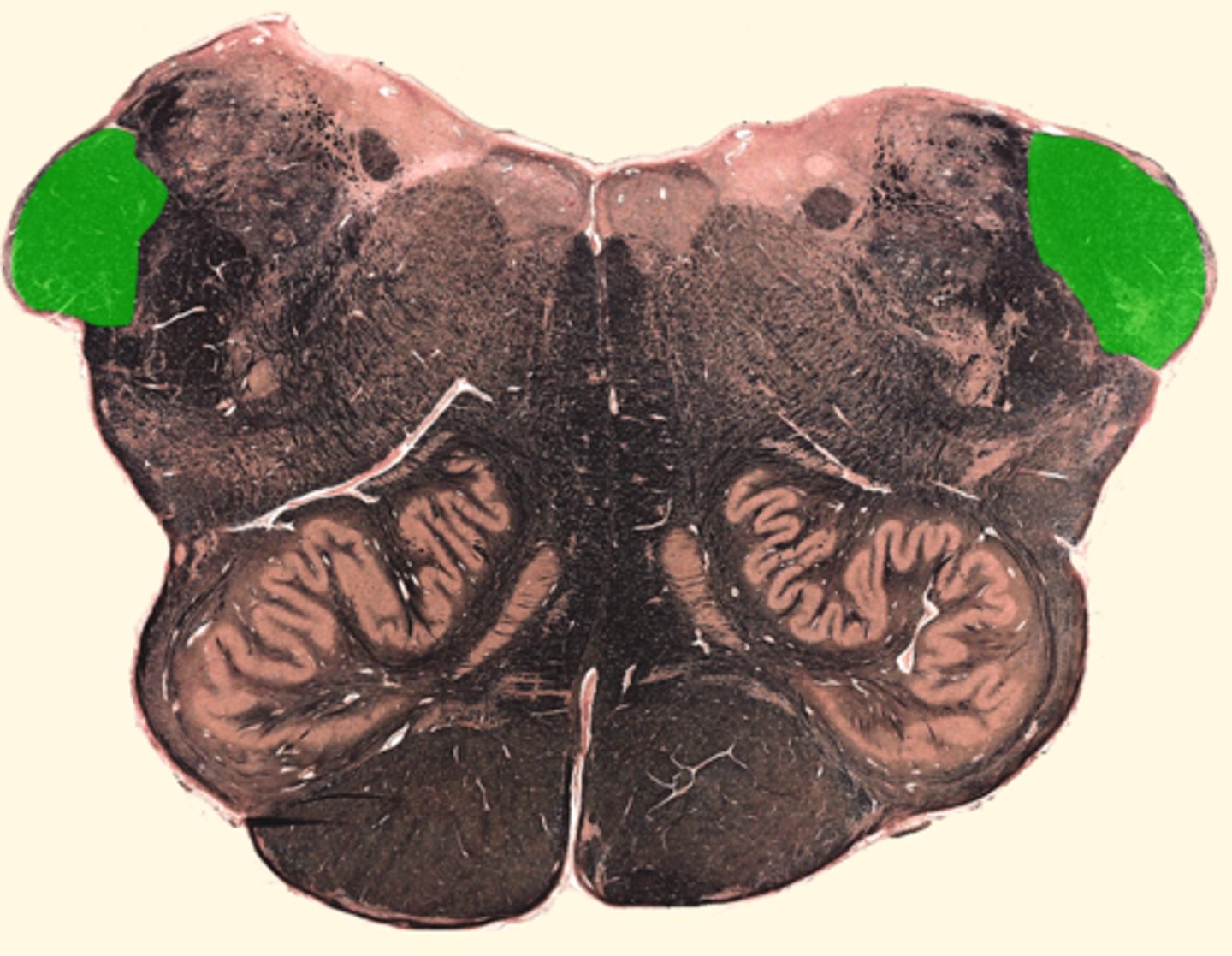 <p>connects the cerebellum to the medulla oblongata</p>