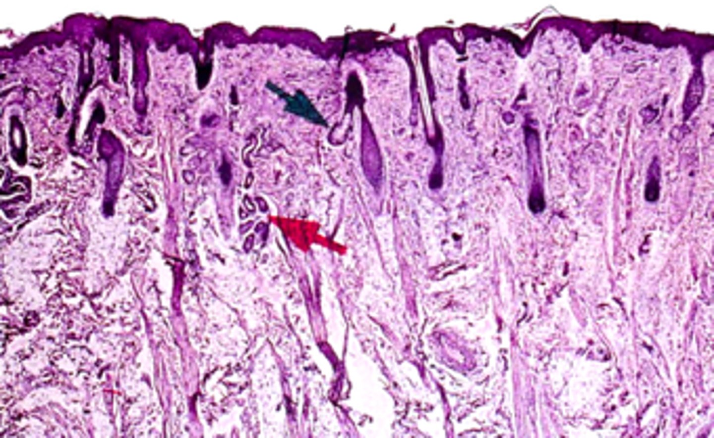 <p><em>what part of the labial mucosa is this:</em></p>