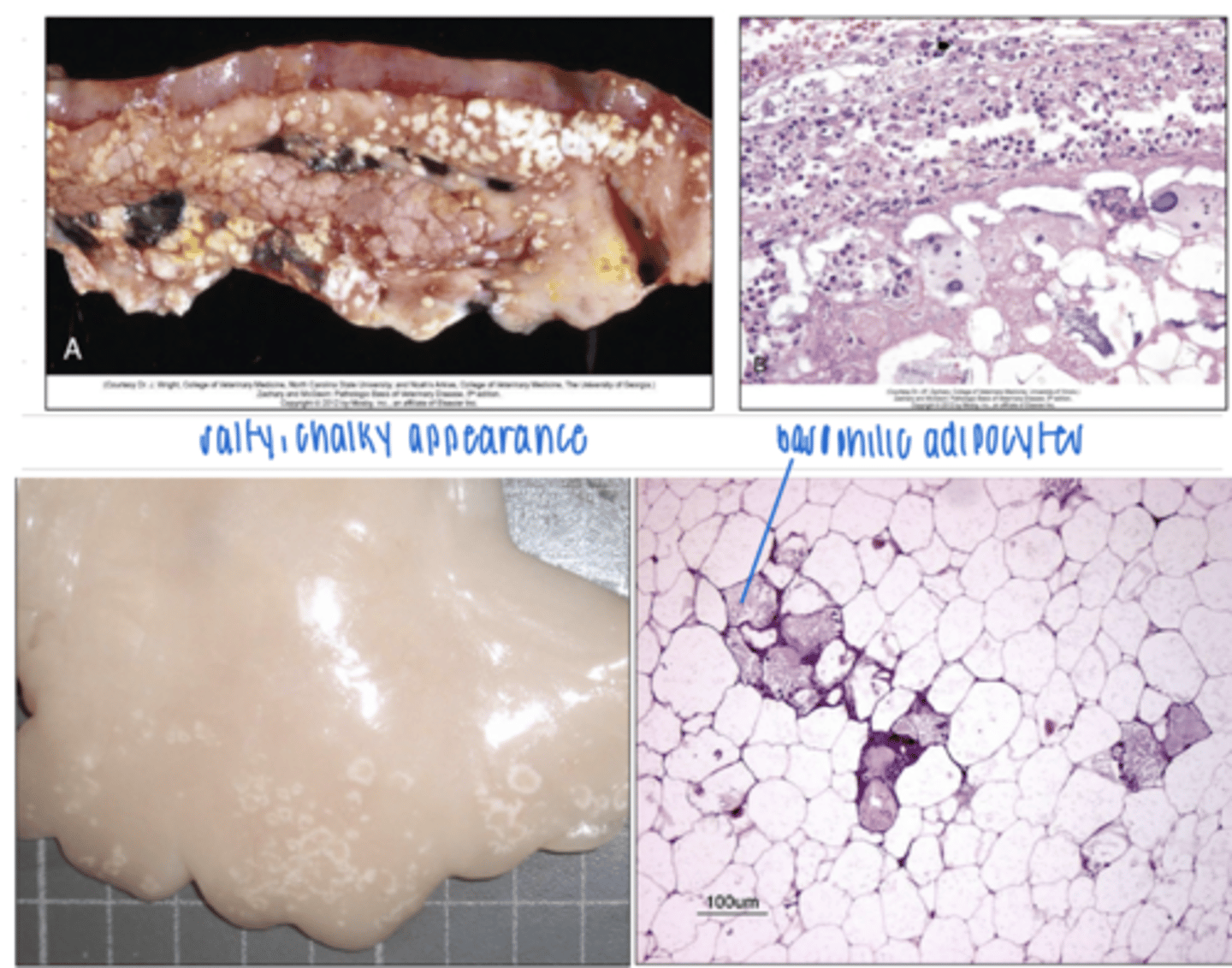<p>grossly:</p><p>dry, salty</p><p>microscopically:</p><p>if there is saponification, necrotic adipocytes are basophilic</p>