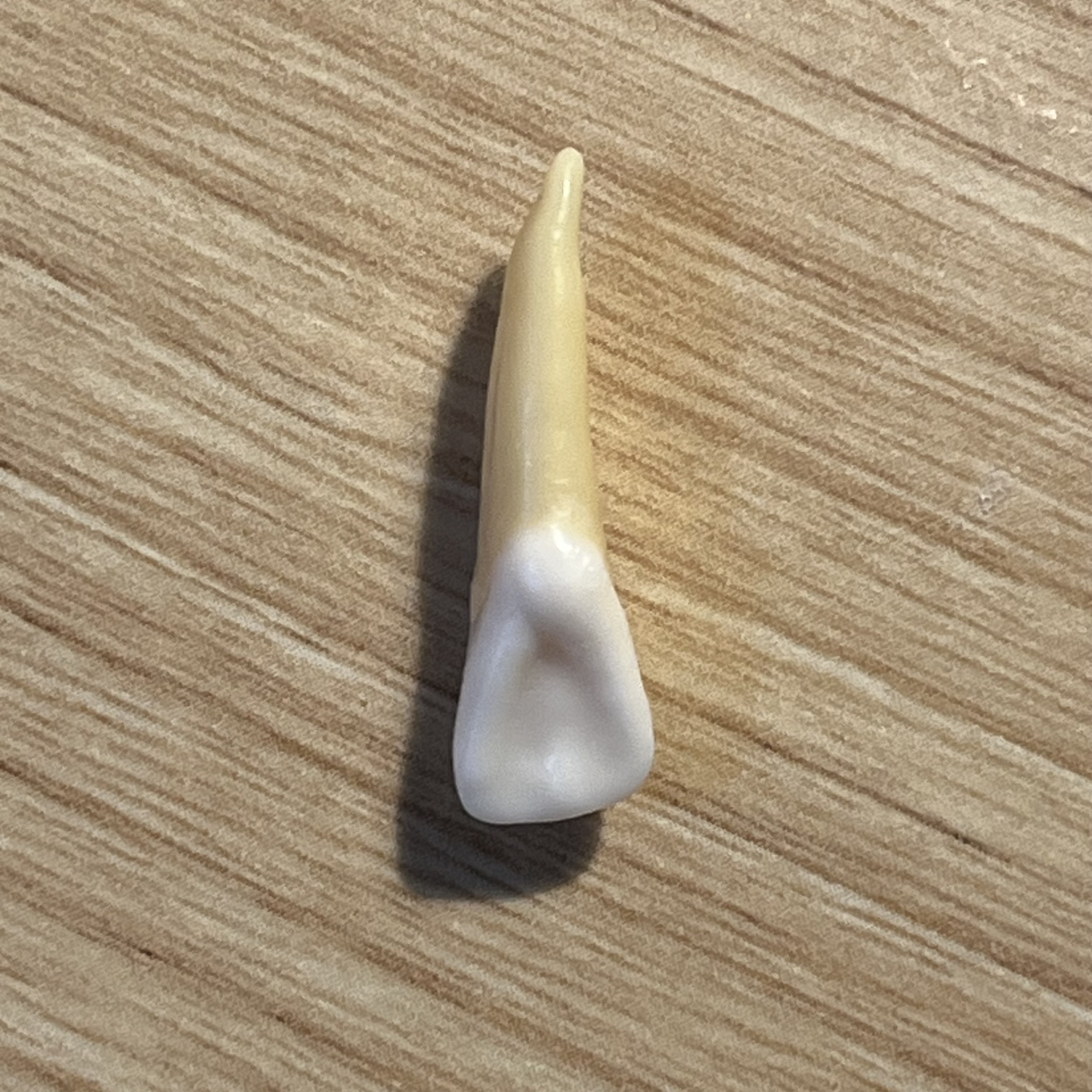 <p>What tooth is this (with view)?</p>