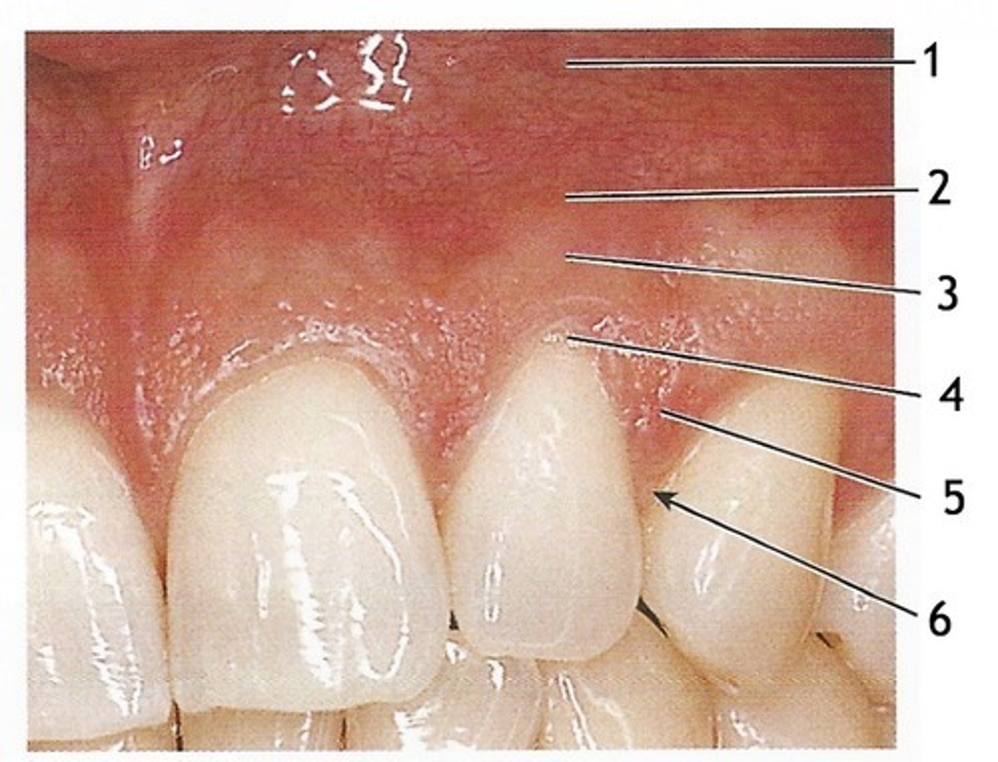 <p>identify parts of the gingiva</p>