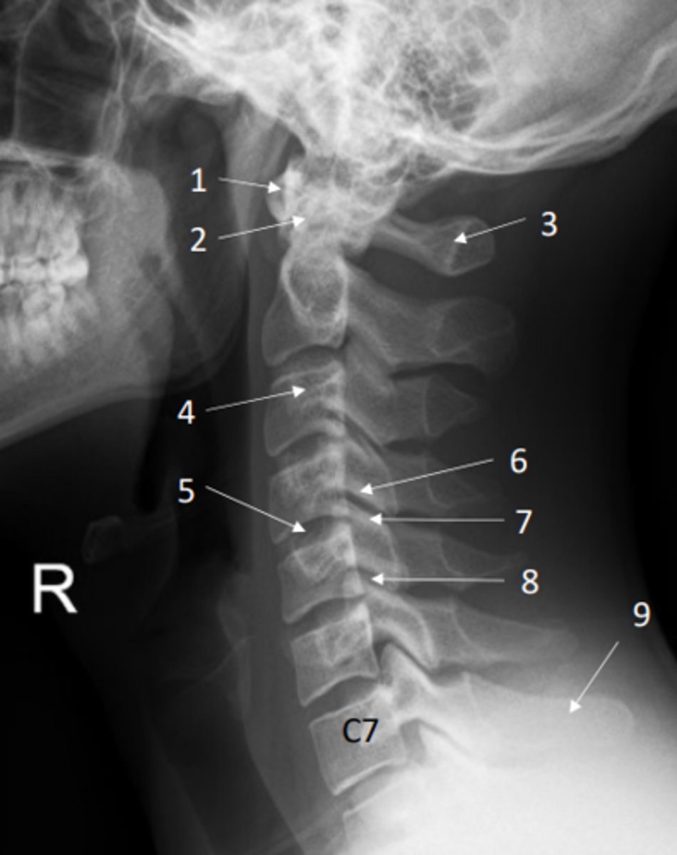 <p>1</p>
