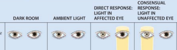 <p>Where is the lesion here? </p>