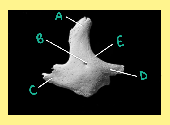 <p><u>Name the following</u>:</p><ul><li><p>Bone?</p></li><li><p>Side?</p></li><li><p>View?</p></li><li><p>B?</p></li></ul><p></p>