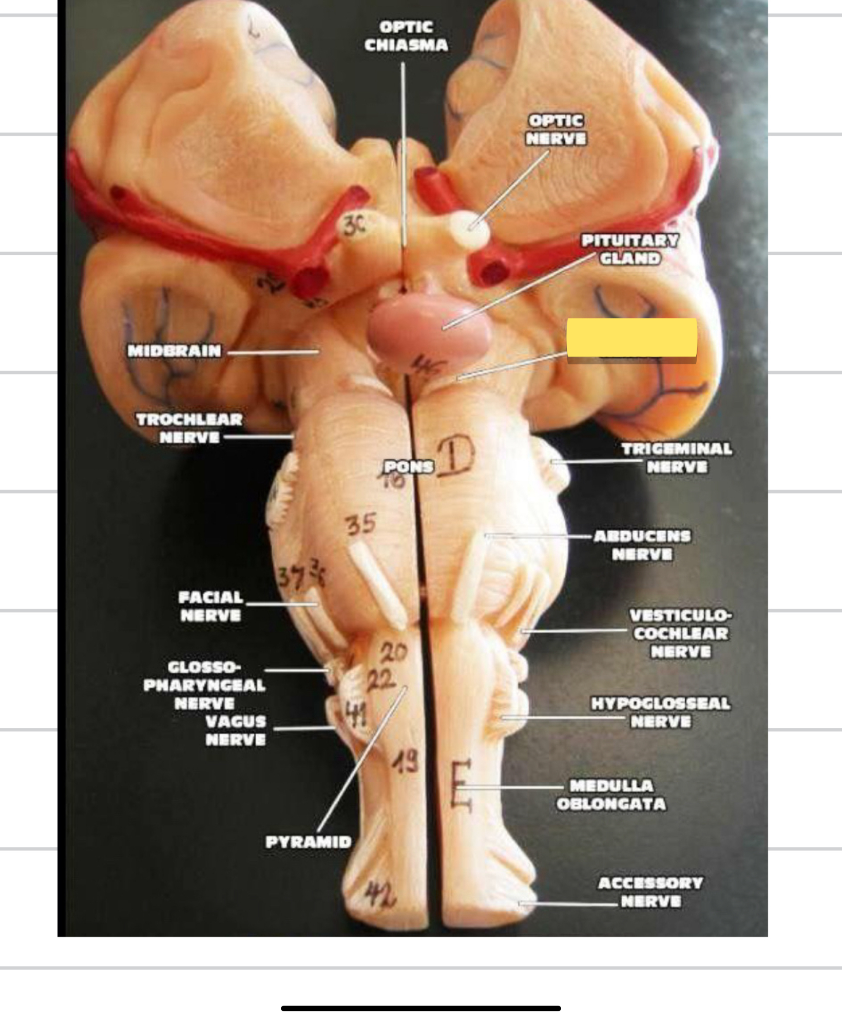 <p>Name this cranial nerve&nbsp;</p>