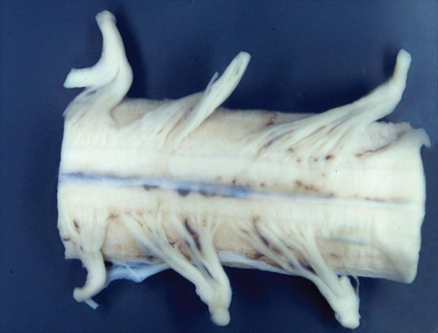 <p>A cable of neurons extending from the brain down through the backbone.</p>