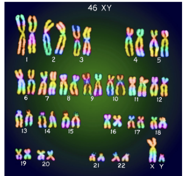 <ul><li><p>A&nbsp;picture&nbsp;of all the chromosomes in a cell, arranged in pairs.</p></li><li><p>Helps doctors spot&nbsp;chromosome disorders&nbsp;(like Down syndrome).</p></li><li><p>Show the complete diploid set of chromosomes that are grouped together in pairs arranged in order of decreasing size.</p></li></ul><p></p>