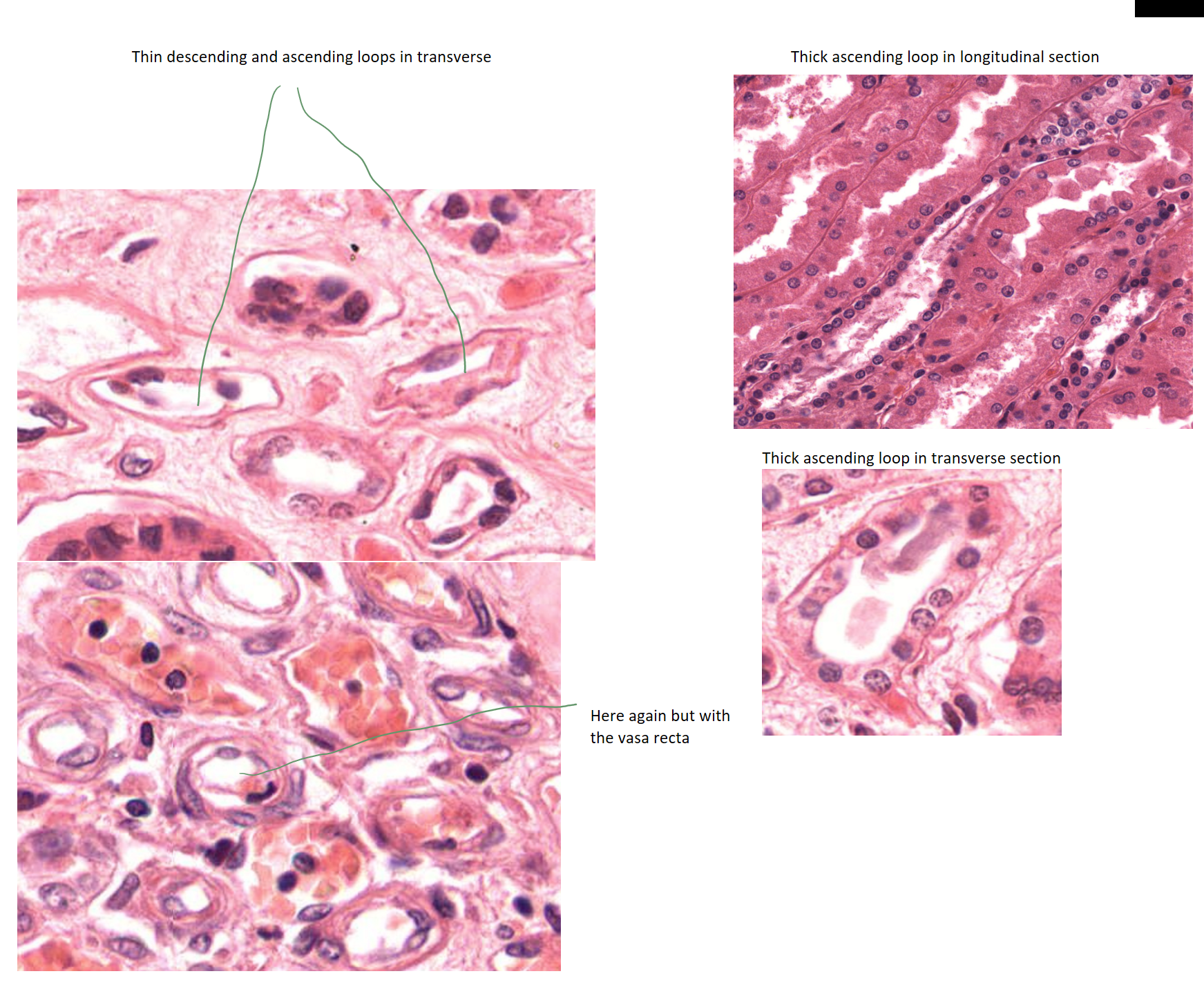 <p>simple squamous vs simple cuboidal</p>