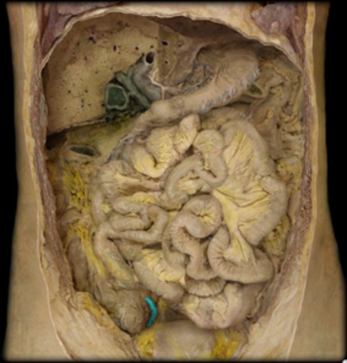 <p>Name this structure.</p>