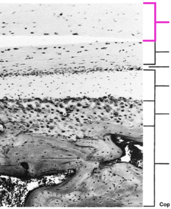 <p>Identify the histological structure of the adult mandibular condyle</p>
