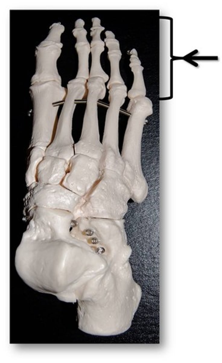 <p>Name these specific bones of the foot.</p>