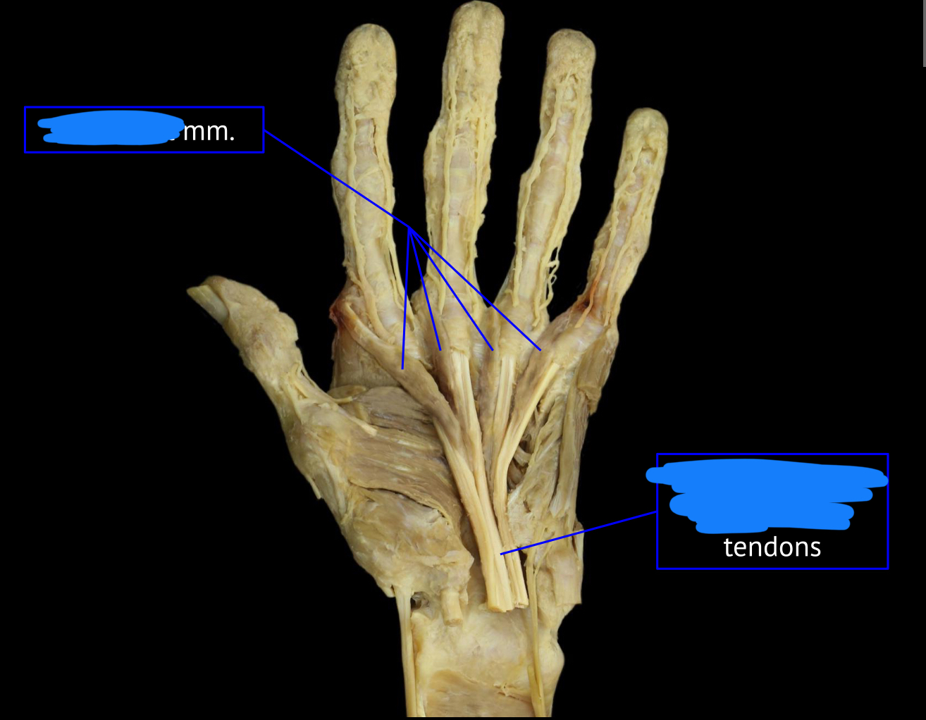 <p>name the muscle </p>
