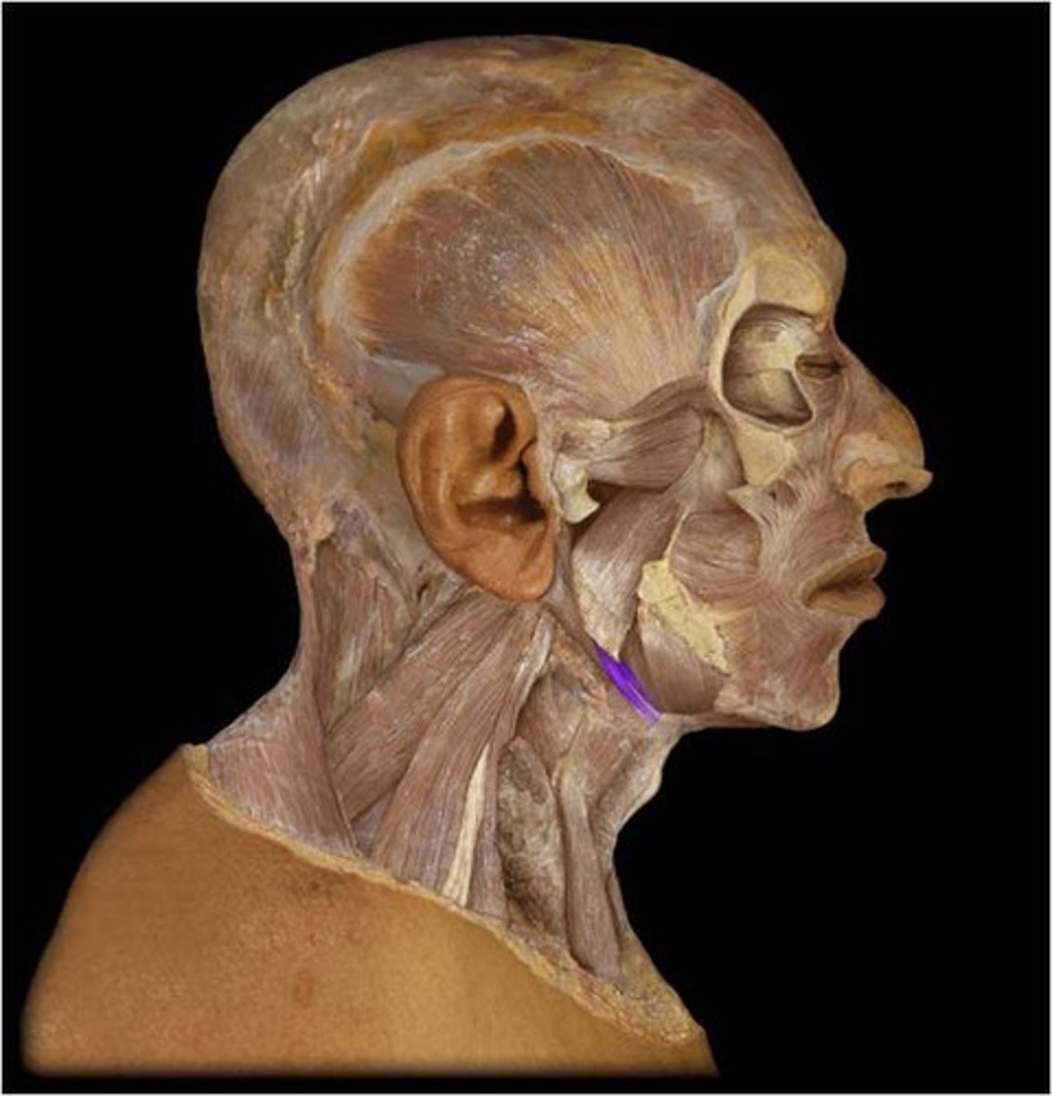 <p>Name the Muscle</p>