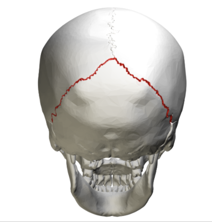 <p>what is this skull feature? </p>