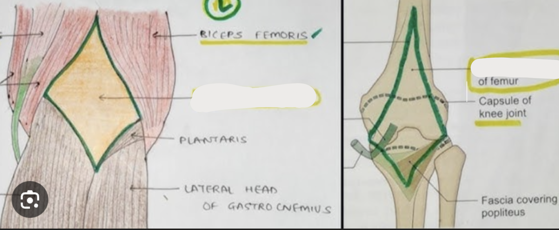 <p>distal end of femur: </p>